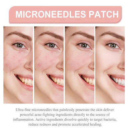 Derma Smooth Skin Tag Removal Patch
