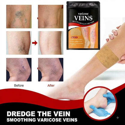 Varicose Veins Health Care Paste | Pain Relief & Blood Circulation Support (Pack of 60) Buy 1 Get 1 Free